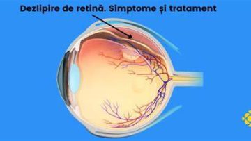 retina