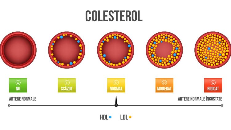 colesterol
